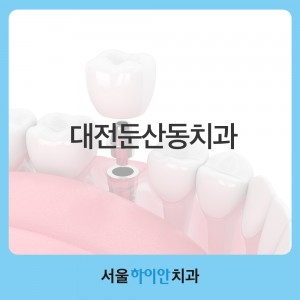 대전둔산동치과 잘하는 곳을 선택하는 기준은