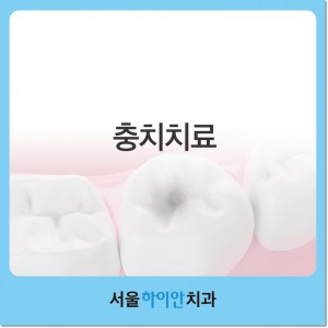 둔산동충치치료 증상에 맞춘 방법으로