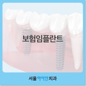 대전보험임플란트 적용혜택과 대상은?