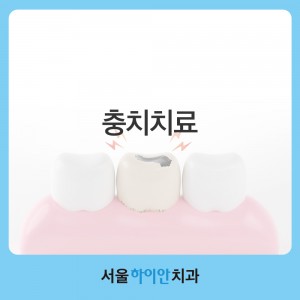 둔산동치과 충치치료 미루지 말고