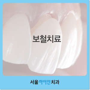 대전서구치과 보철치료 자연스러운 미소를 되찾으려면