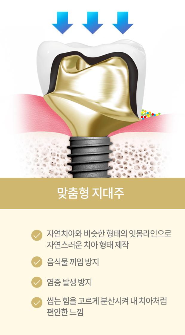 맞춤형 지대주