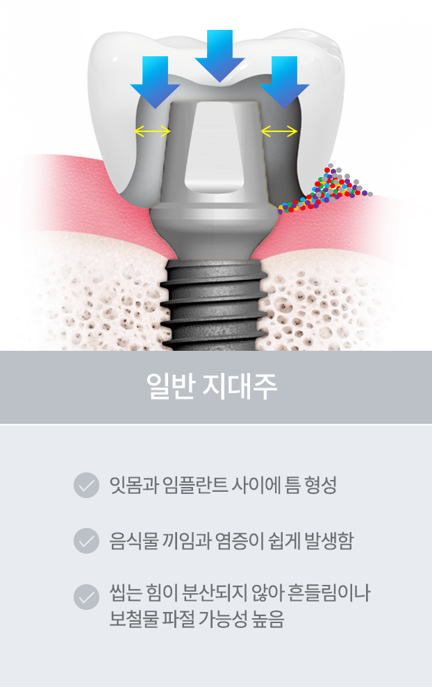 일반 지대주